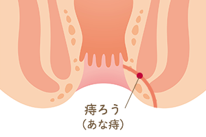 多治見市にある安藤クリニックの肛門外科ページ 多治見市で肛門外科なら安藤クリニック