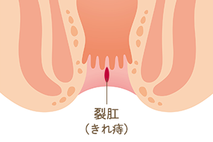 多治見市にある安藤クリニックの肛門外科ページ 多治見市で肛門外科なら安藤クリニック