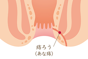 多治見市にある安藤クリニックの手術について 多治見市で肛門外科なら安藤クリニック